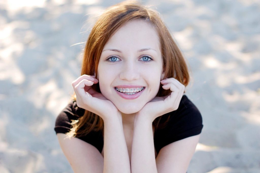 Metal braces Miler Orthodontics dentist in Bluffton, South Carolina Dr. Miler