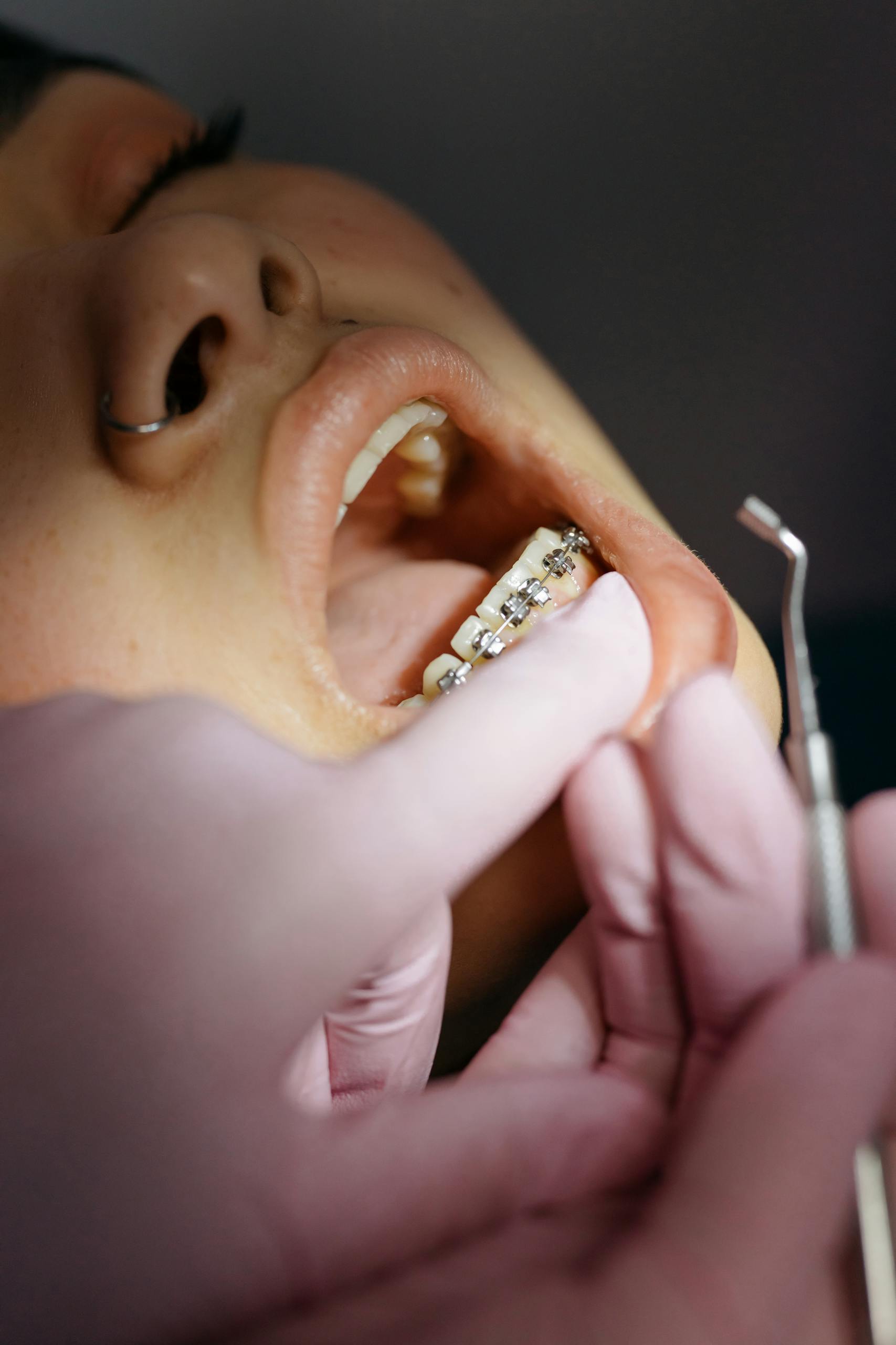 Dentist examining patient's braces during a dental appointment.